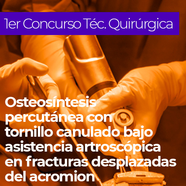 Osteosíntesis percutánea con tornillo canulado bajo asistencia artroscópica en fracturas desplazadas del acromion