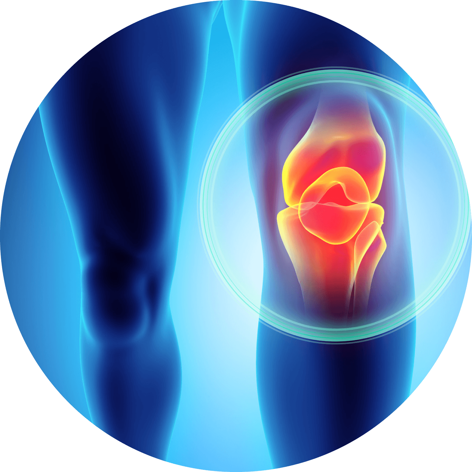 Ilustración de dolencia de rodilla