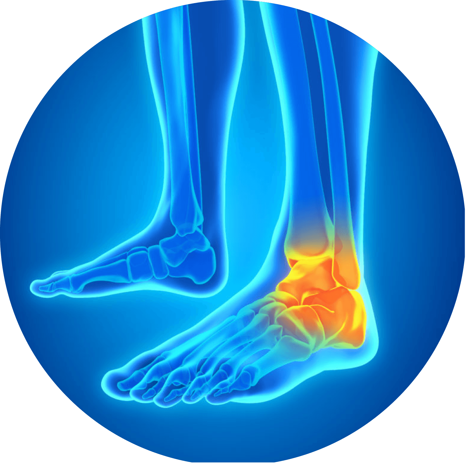 Ilustración de piernas estilo rayos X